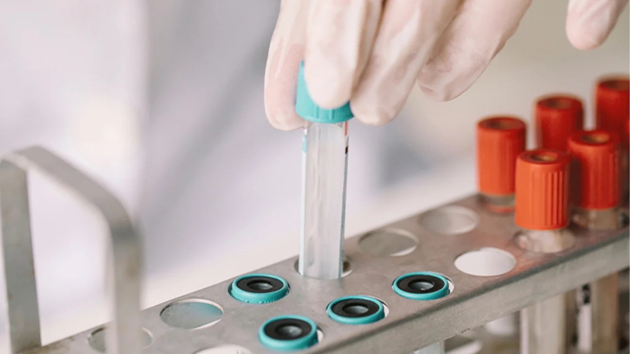 blood sample test lab 1296x728 header