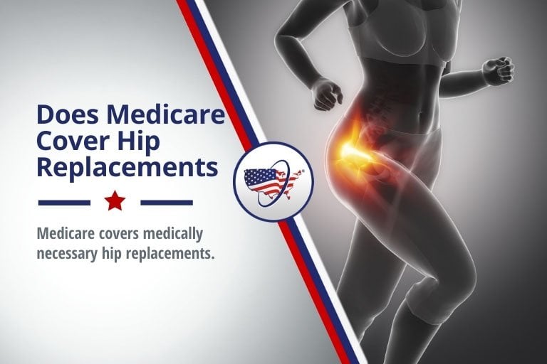 does medicare cover hip replacements