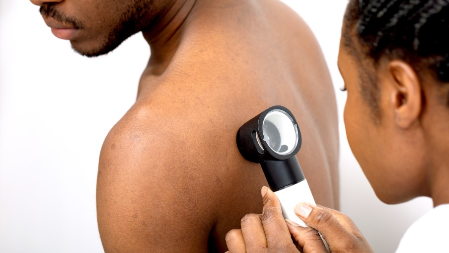 does medicare cover skin cancer screening