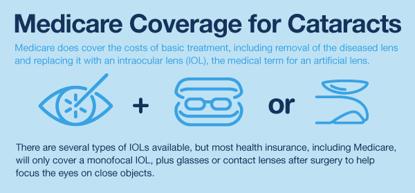 medicare coverage for cataracts